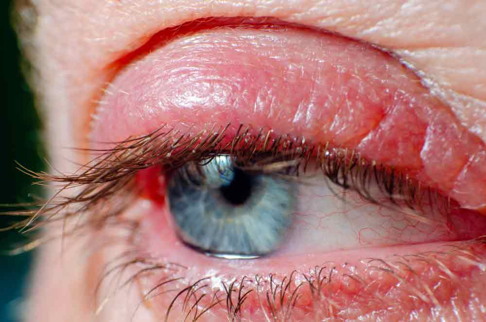Основные заболевания кожи и глаз